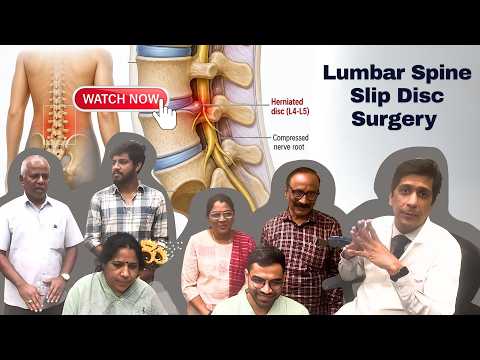 Patient Testimonials | Dr. Ajay Kothari - Minimally invasive endoscopic, scoliosis & Spine Surgeon | Shivaji Nagar, Pune