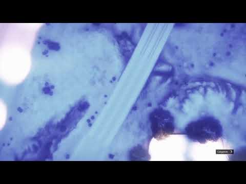 Fre27 pro|golpe casino