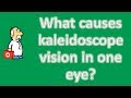 What causes kaleidoscope vision in one eye ? | Most Rated Health FAQ Channel