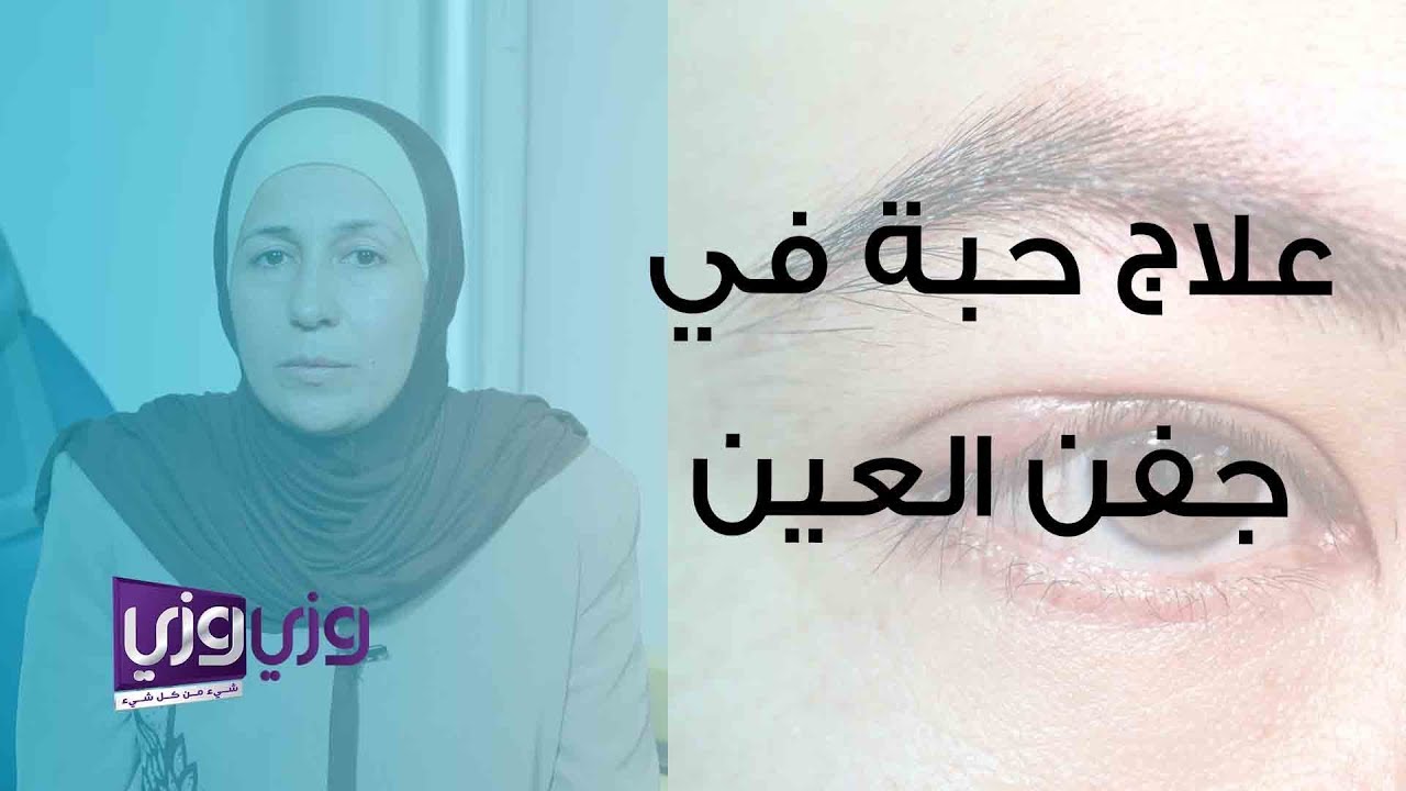 علاج حبة في جفن العين