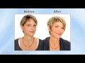 Update Top Plastic Surgeon in Grand Junction CO 970 242 9127 Call Us Today , Video JCAHO Medication Labels paling update!
