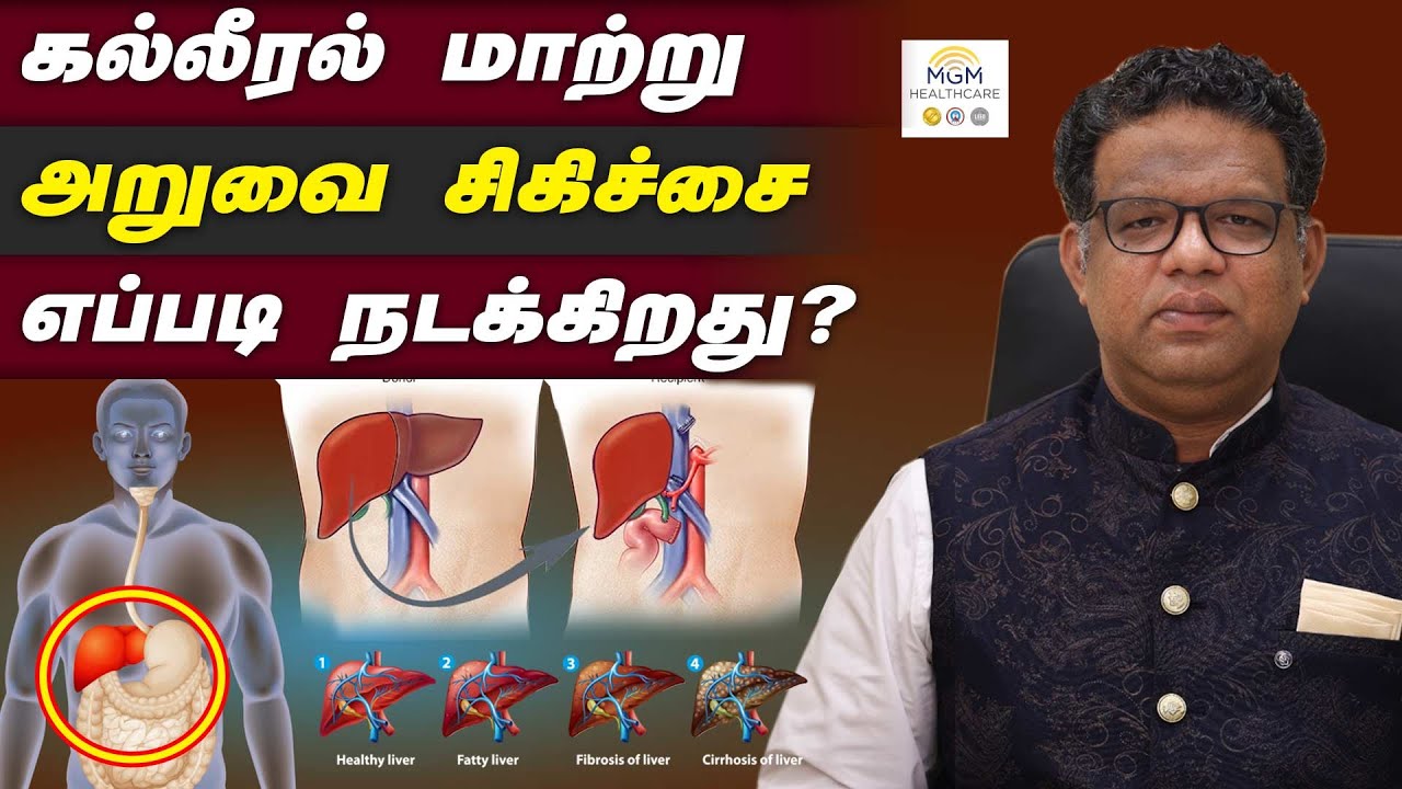 கல்லீரல் மாற்று அறுவை சிகிச்சை எப்படி நடக்கிறது ? | MGM Healthcare | Dr. Thiagarajan Srinivasan