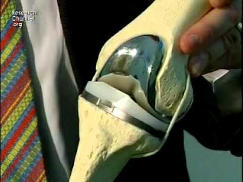 21 Übung schlanke Beine und Schmerzen vom Hals lindern und zurück Behandlung eines eingeklemmten Nervs zurück