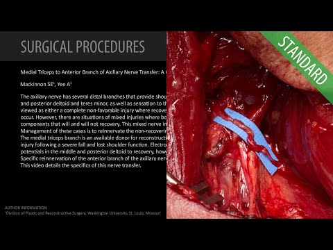 Transfer von Ästen des N. radialis, die den medialen Kopf des M. triceps brachialis innervieren, auf den vorderen Ast des N. axillaris: ein Fall einer spezifischen Rekonstruktion der Innervation (mit Dr. Mackinnon)