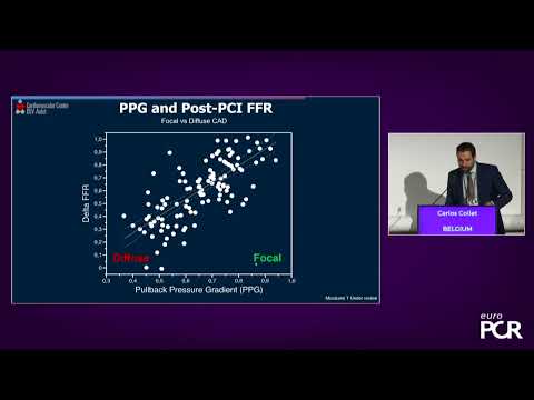 Pressure microcatheter guided PCI: to optimise stent implantation and  assess the functional result