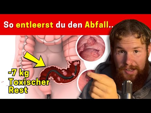 Instantly remove 7kg of waste from your intestines (10 tricks)