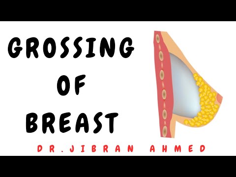 OSTEOGENIC TX II FLETCHERS 5TH E II ROBBINS 10TH E II POST GRADUATE LEARNING II DrJIBRANAHMED