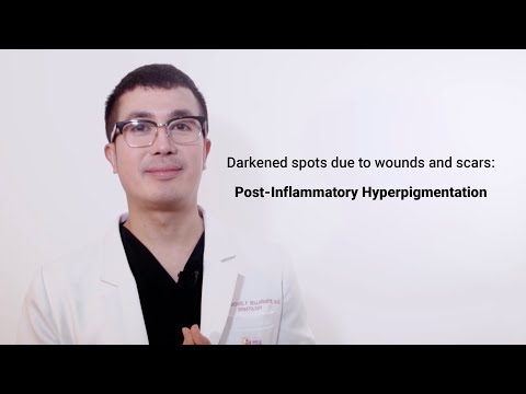 Darkened spots due to wounds and scars: Post-Inflammatory Hyperpigmentation
