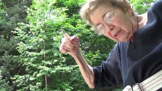 "If you look really closely, you can see the scars."