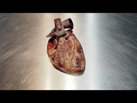 Anatomia do coração parte 1: morfologia externa e vasos da base