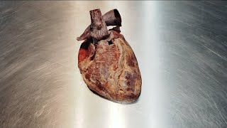 Anatomia do coração parte 1: morfologia externa e vasos da base