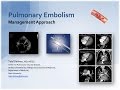 Pulmonary Embolism An Approach To Management BAVLS