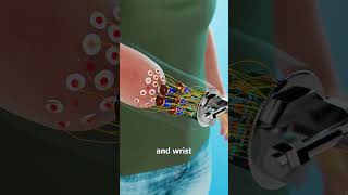 He Built His Own Replacement Hand 😮