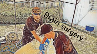 נראה איך נתקן את הניקוז הזה. בלי לחפור!