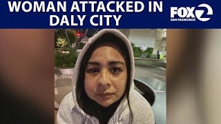 Culinary school grad attacked outside Nation's in Daly City | KTVU