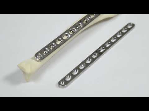 Axial Compression Plating of a Transverse Fracture with a Dynamic Locking Plate (Technique Overview)