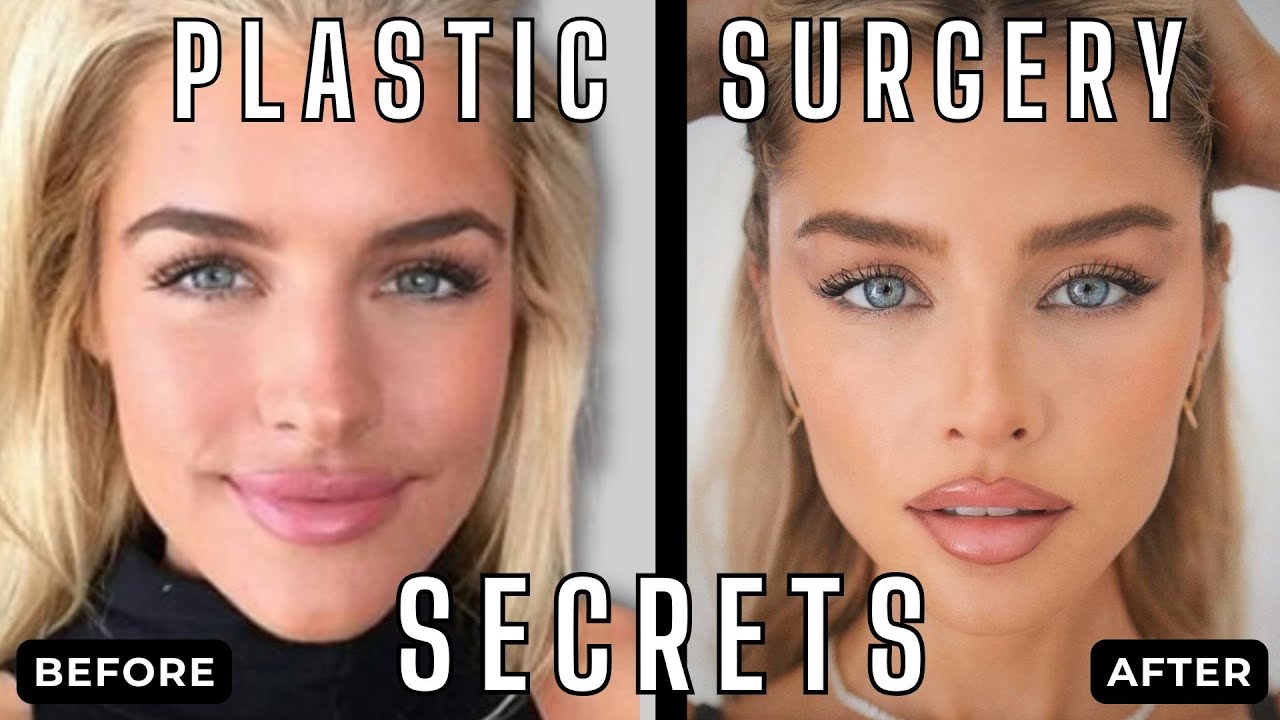 You're Not Ugly. You're Just Poor: The Truth About Influencer Beauty