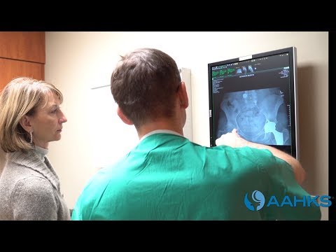 Hip Replacement Surgery - Mini-Posterior Approach Video