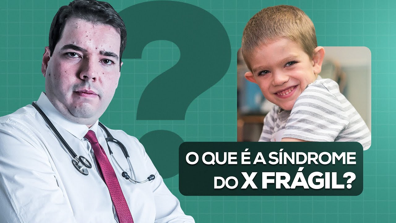 Síndrome do X Frágil - Tudo Sobre Síndrome do X Frágil