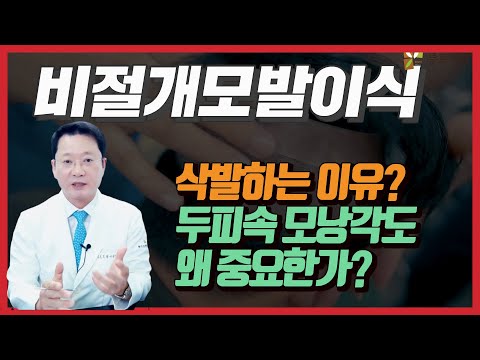 通过超声波扫描确认非切开毛发移植剃发的理由头皮内毛囊的角度。 毛囊损伤最小化根毛移植