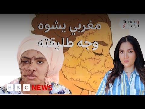 فيديو | رجل يشوه وجه طليقته في المغرب.. قصة إيمان ابنة مدينة تازة تهز الشارع المغربي