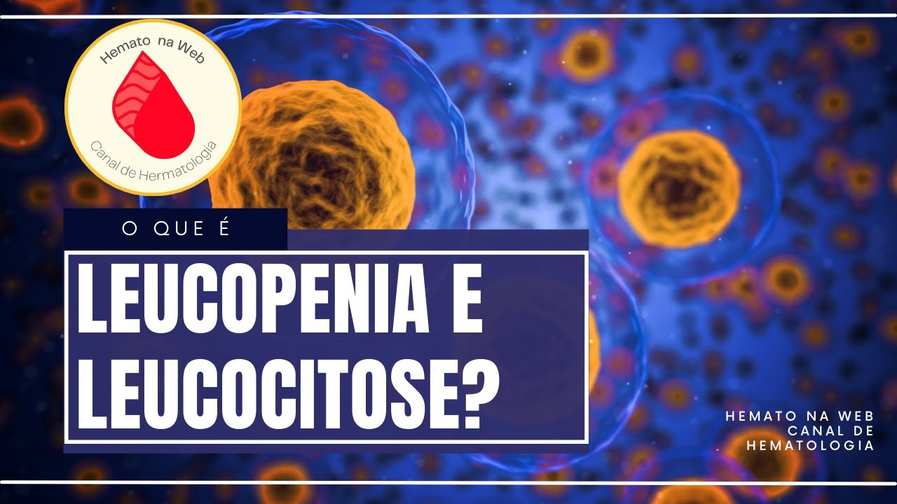 Leucopenia e leucocitose, o que devemos saber? | Geydson S Cruz; MD,MSc