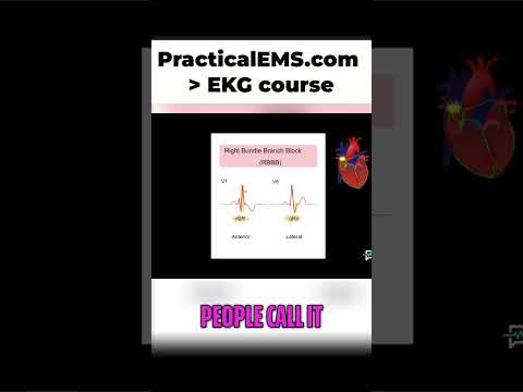 Right Bundle Branch Block: ECG Made Easy!