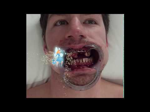 San Jose Sharks' Logan Couture Gets A Visit From the Tooth Fairy