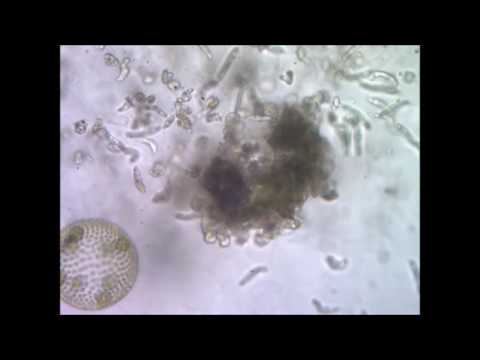 Peranema wolf pack eating a Volvox colony