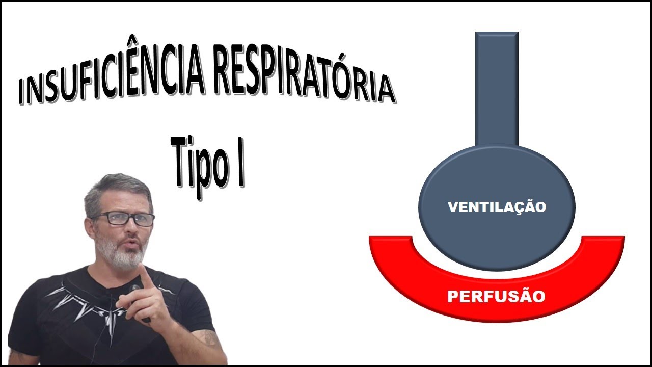 Insuficiência respiratória do tipo I ou HIpoxêmica
