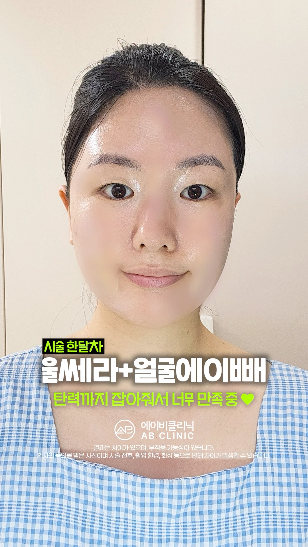 매끈 V라인 찾는 방법