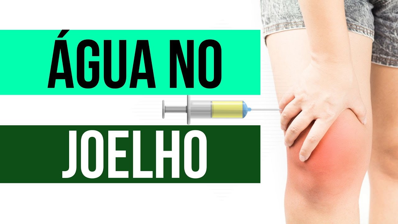 EXERCÍCIO PARA MELHORAR O DERRAME ARTICULAR?