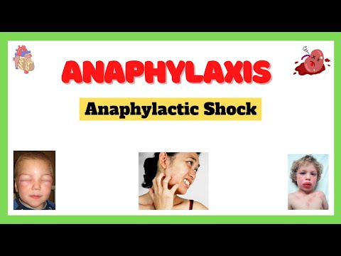 Anaphylactic Shock (Anaphylaxis)| Signs and Symptoms, Causes, Complications, Treatment| Made Easy