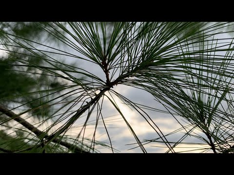 Flatback Spine Revision Surgery:  My Story-Day 100 of Post-op Recovery