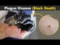 Plague - Black Death | Symptoms, Causes And Treatment (Urdu/Hindi)