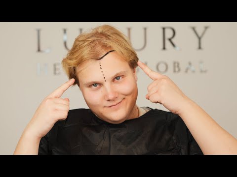 From USA to Turkey | Natural & New Hairline Hair Transplant in Istanbul