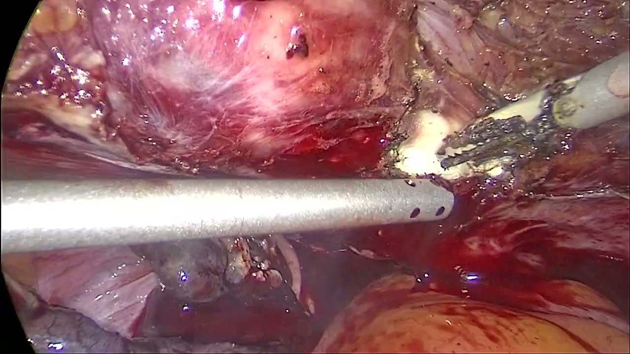 Jorge Alberto Rodriguez Pezino-71