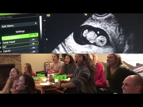 Stanford Beach Volleyball coaches surprise team with baby announcement