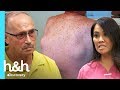 ¿Qué son esos bultos en la espalda? | Dra. Sandra Lee: Especialista en piel | Discovery H&H