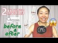 Medical Grade Skincare Brands | I Used Osmosis Skincare for 2 months | Results & more...