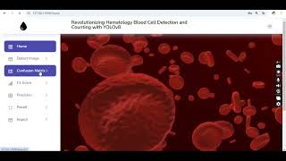 Revolutionizing Hematology Blood Cell Detection and Counting with YOLOv8