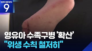 이른 더위에 ‘수족구병’ 빨간불…2주 만에 3배↑ [9시 뉴스] / KBS 2026.06.14.