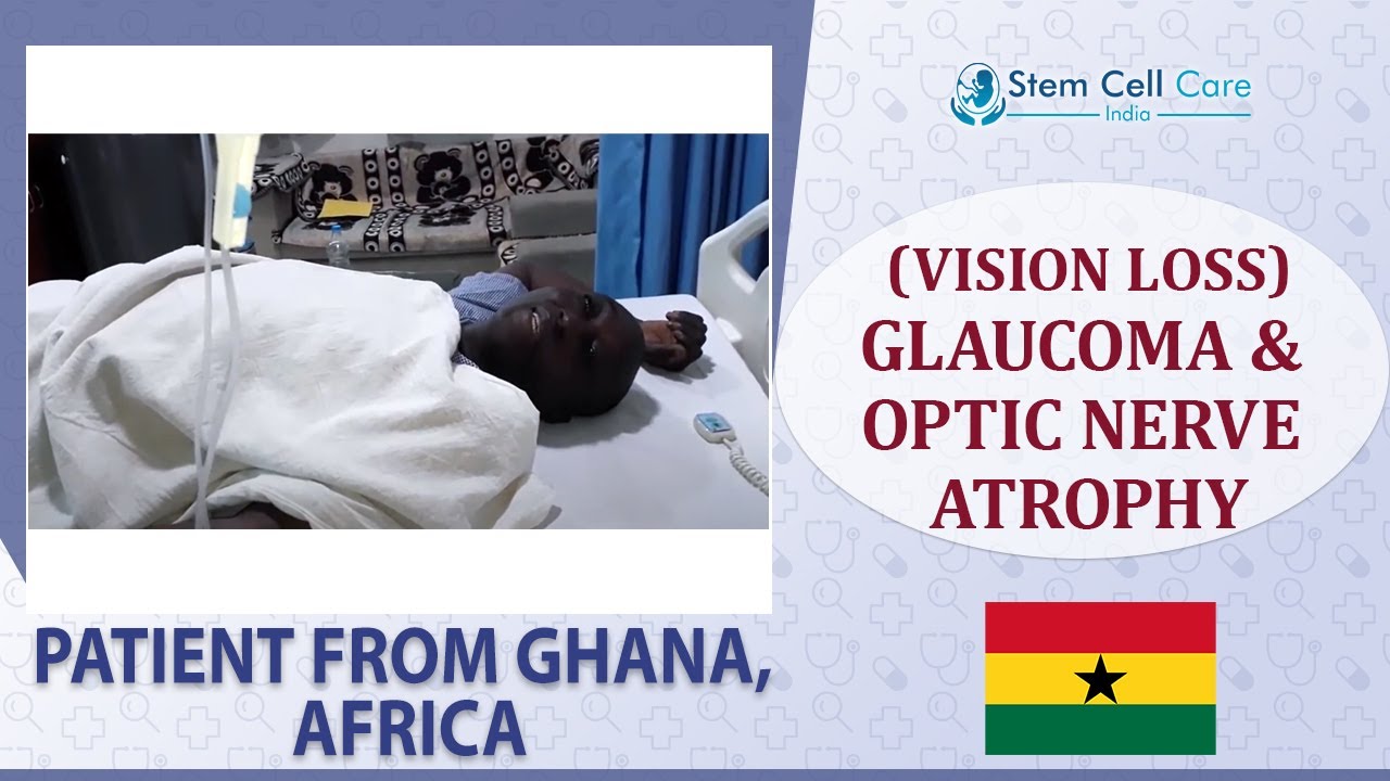 Patient with Glaucoma & Optic Nerve atrophy shares his experience after stem cell therapy at SCCI