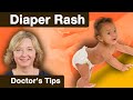 Dermatologist vs. Diaper Rash: How to Treat It & How to Apply Diaper Rash Cream | AAP