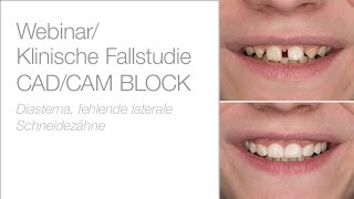 edelweiss CAD/CAM BLOCKs - Webinar & Patientenfall mit Dr. Stephan Lampl