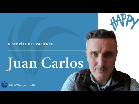 Comentarios postoperatorios -7- (Transplante de pelo)