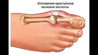 Ссылка