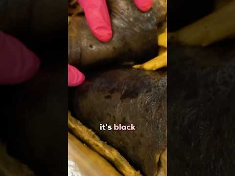 Our Most Common Request: Show Us Smokers Lungs