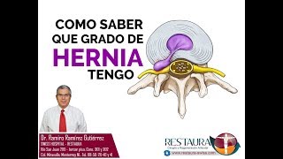 ¿Cómo saber de qué grado es mi hernia de disco