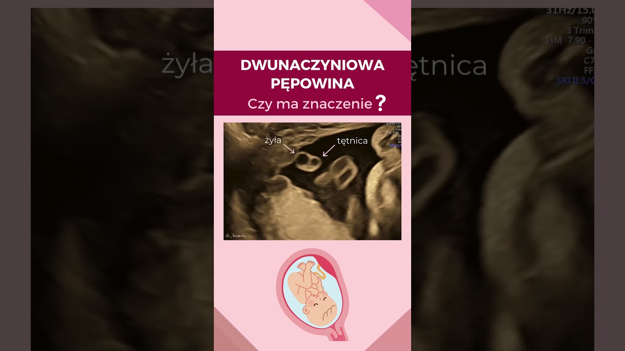 Anita Hamela-Olkowska-13